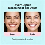 Blanchiment Dentaire : Ce Qu&rsquo;Il Faut Savoir