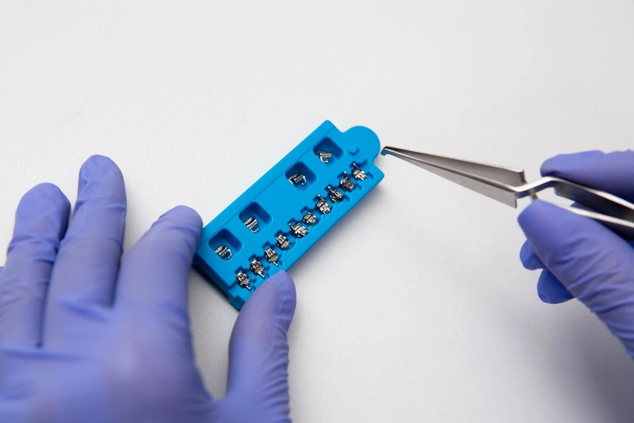 Appareil orthodontique dentaire avec bagues bleues - Cabinet dentaire moderne Maroc